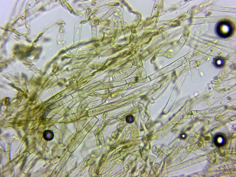 Agaricus sylvaticus 13 - Cutícula x 400